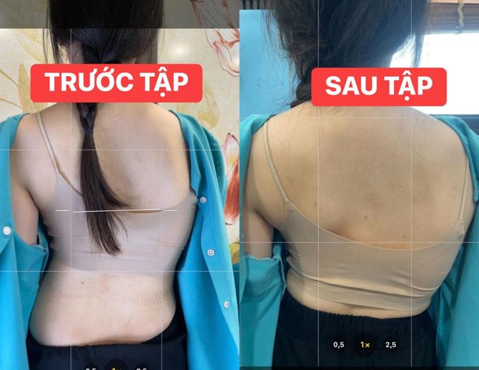 Đường cong lưng trước – sau tập