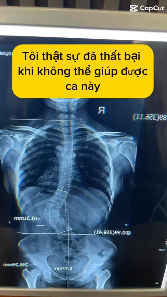 Tôi không biết bao nhiêu lần phải từ chối những khách hàng như vậy
