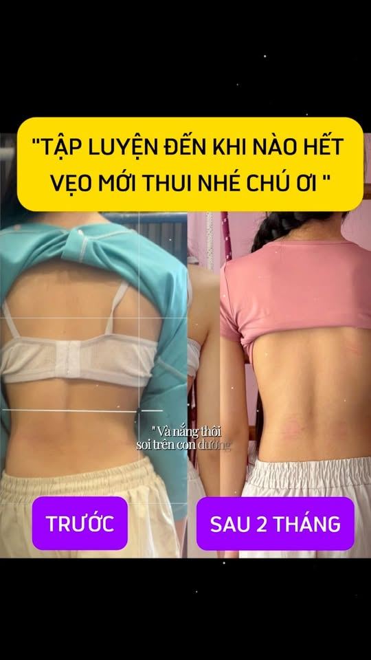 Tập luyện đến khi nào hết vẹo mới thôi