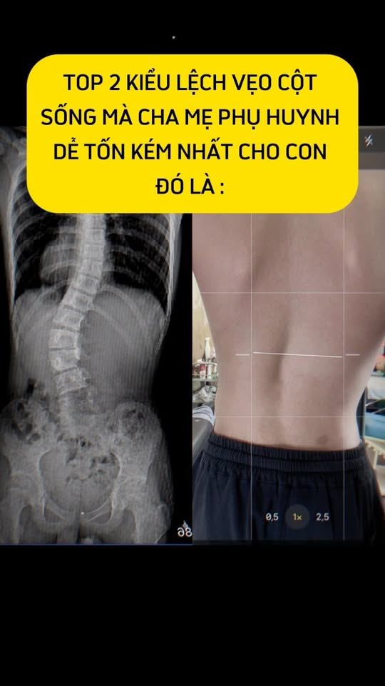 Top những kiểu lệch vẹo tốn kém nhất cho bố mẹ